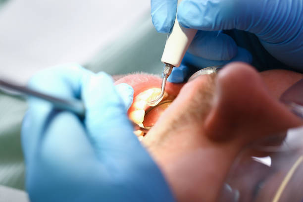 Best Walk-In Emergency Dentist in Cloverdale, VA