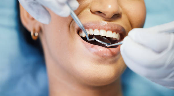 Best Same-Day Emergency Dentist in Cloverdale, VA