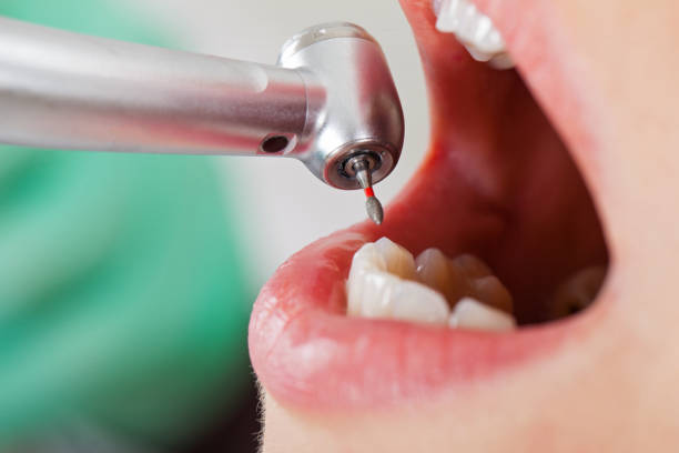 Best Same-Day Emergency Dentist in Cloverdale, VA
